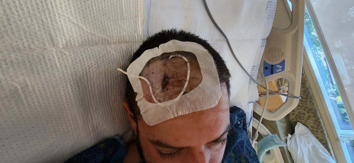 BrainAneurysmUnableToPayBill