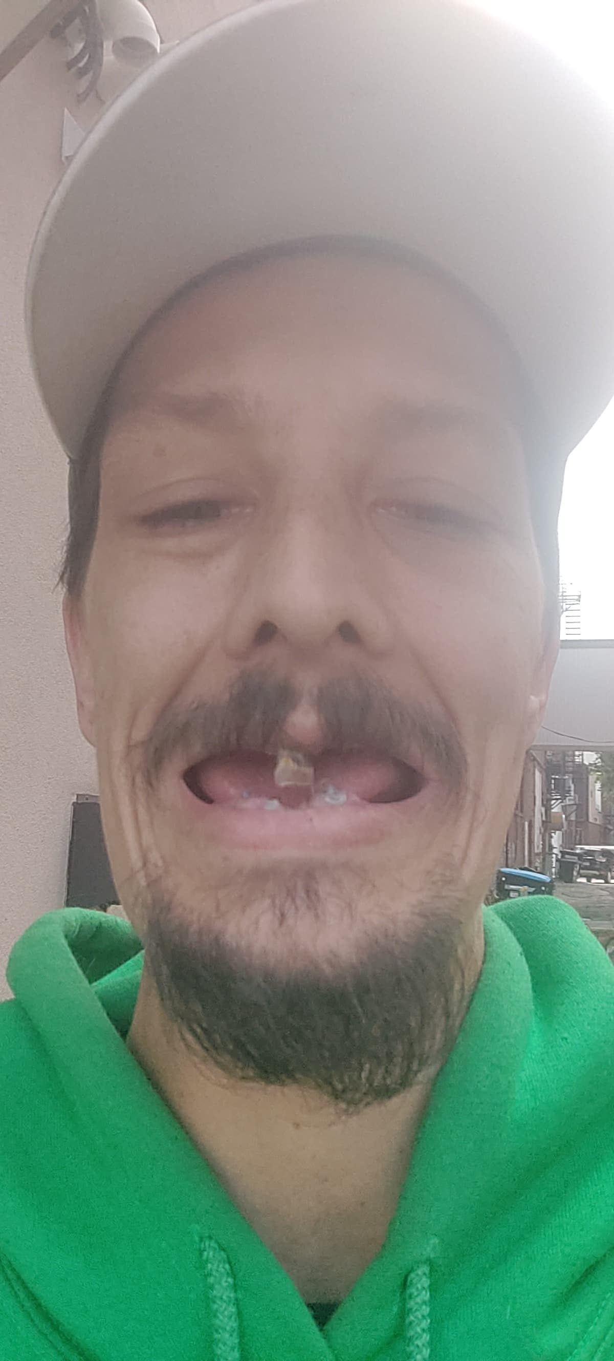 KnockedOutTeeth