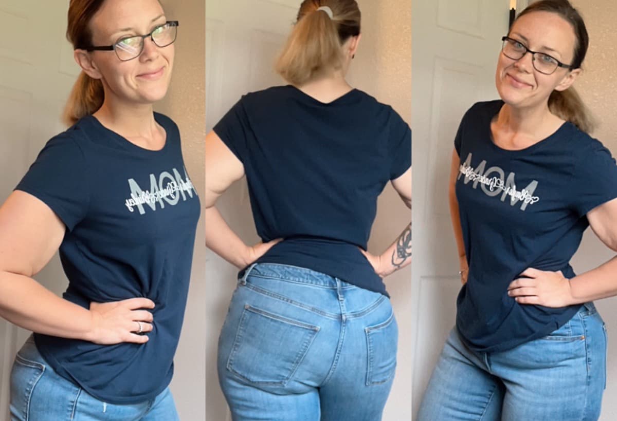 HelpKirstenWithSurgeryCosts