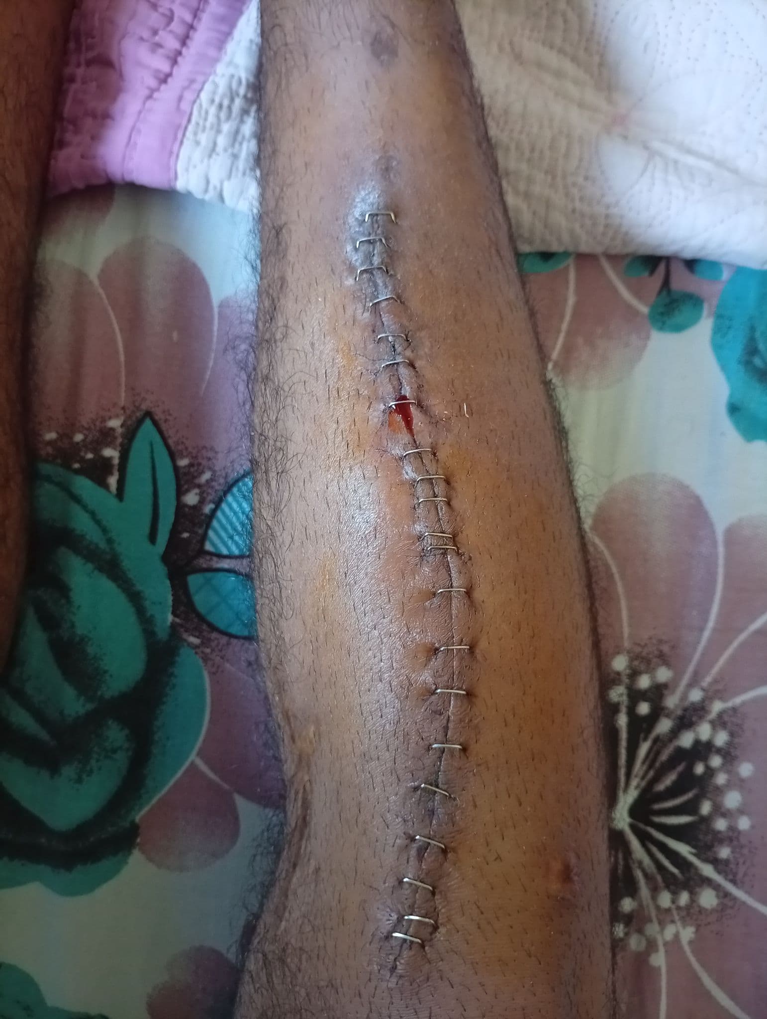 Help Sanad Heal And Support His Family — photo 2