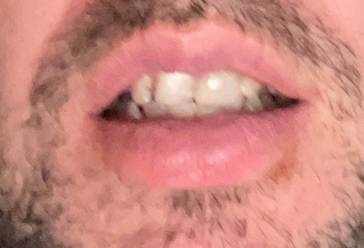 FixADamagedSmile